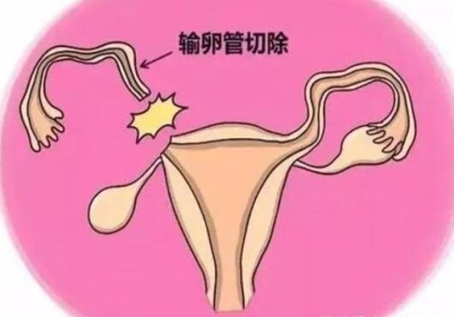 徐州助孕公司：新生儿补钙很重要，这些方式都能帮助新生儿补充钙元素